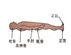 不同部位褥疮如何选择卧床体位有利于恢复