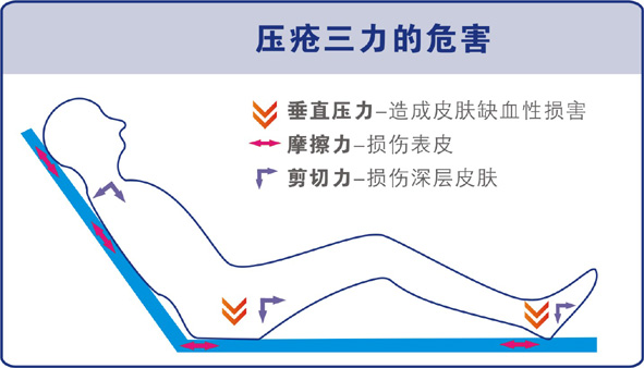 为什么会发生压疮呢